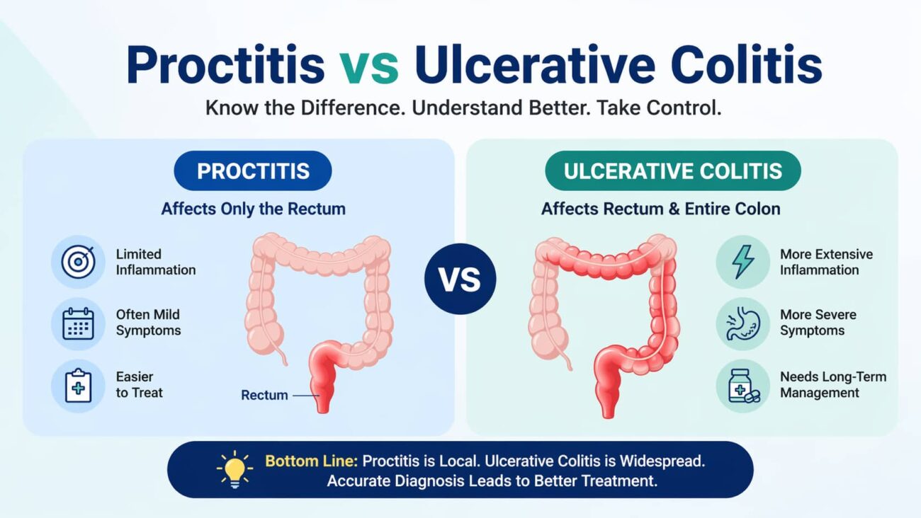 Proctitis vs Ulcerative Colitis comparison infographic showing differences in inflammation, symptoms, and affected areas of the colon